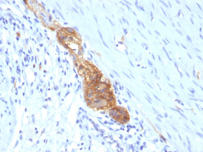 Formalin-paraffin human Colon stained with NCAM-1/CD56 antibody (SPM489)