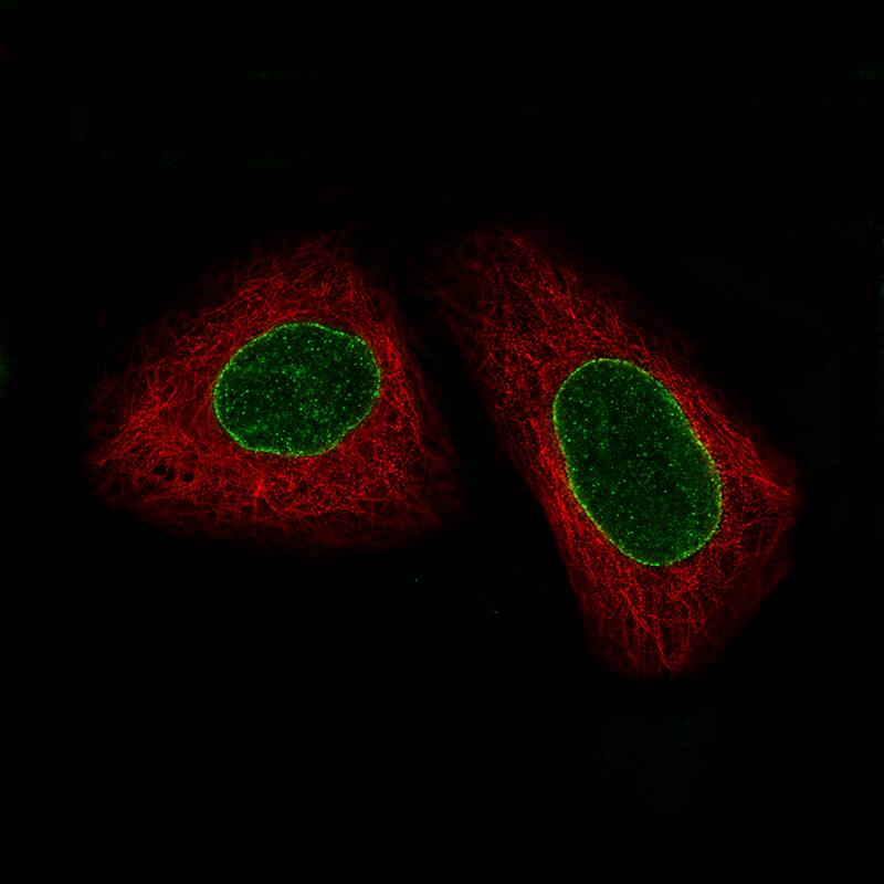 Staining of U-2 OS cells, showing specific staining in the nuclear membrane and nucleus in green. Microtubule- and nuclear probes are visualized in red and blue, respectively (where available).