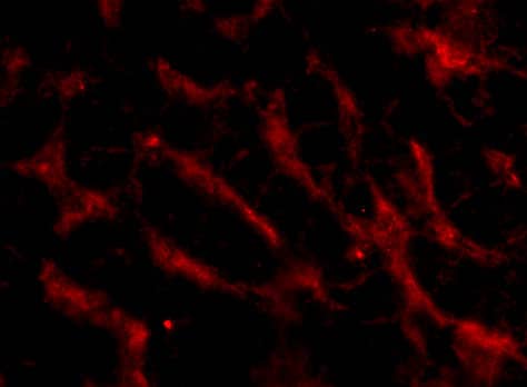 Immunocytochemistry/ Immunofluorescence: TWEAK R/TNFRSF12 Antibody - BSA Free [NBP2-34499] - Immunofluorescence of TWEAK R/TNFRSF12 in Human Liver cells with TWEAK R/TNFRSF12 antibody at 20 u/mL.