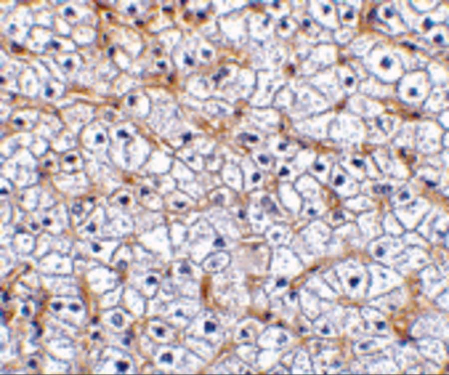 Immunohistochemistry: TWEAK R/TNFRSF12 Antibody - BSA Free [NBP2-34499] - Immunohistochemistry of TWEAK R/TNFRSF12 in human liver tissue with TWEAK R/TNFRSF12 antibody at 2.5 u/mL.