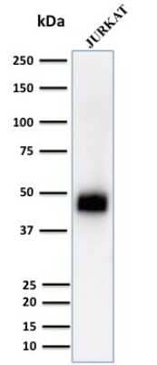 Western Blot: CD2 Antibody (UMCD2) - Azide and BSA Free [NBP2-34508] - Western Blot Analysis of Jurkat Cell lysate using CD2 Mouse Monoclonal Antibody (UMCD2).