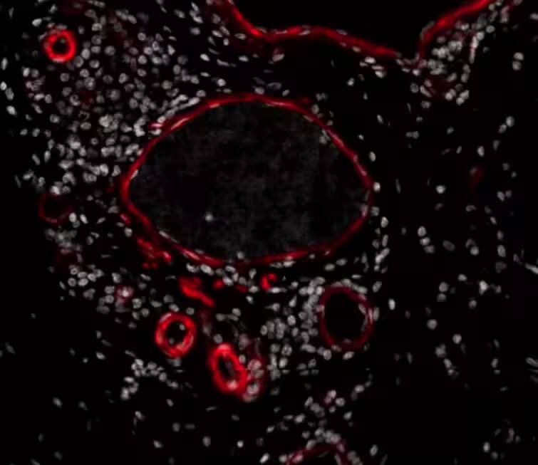 Immunohistochemistry-Paraffin: alpha-Smooth Muscle Actin Antibody (1A4/asm-1) [DyLight 680] [NBP2-34522FR] - aSMA stained over night in human FFPE tonsil section ((Catalog # NBP2-33006AF750)). Heat mediated antigen retrieval at pH 9. 1:50 Dilution in 3% BSA, incubation over night at 4 °C. Image from a verified customer review.