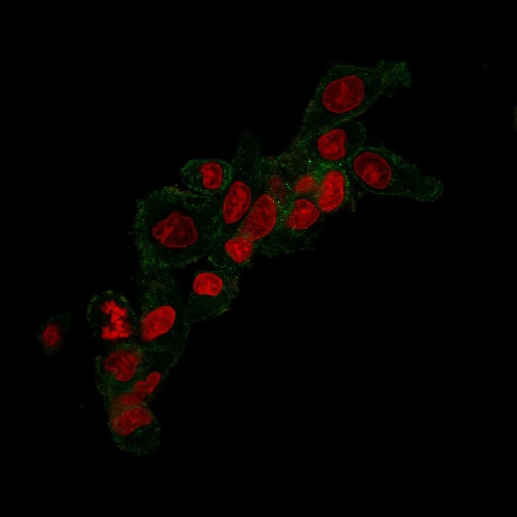 Immunofluorescent staining of MeOH-fixed SLBR3 cells with 
