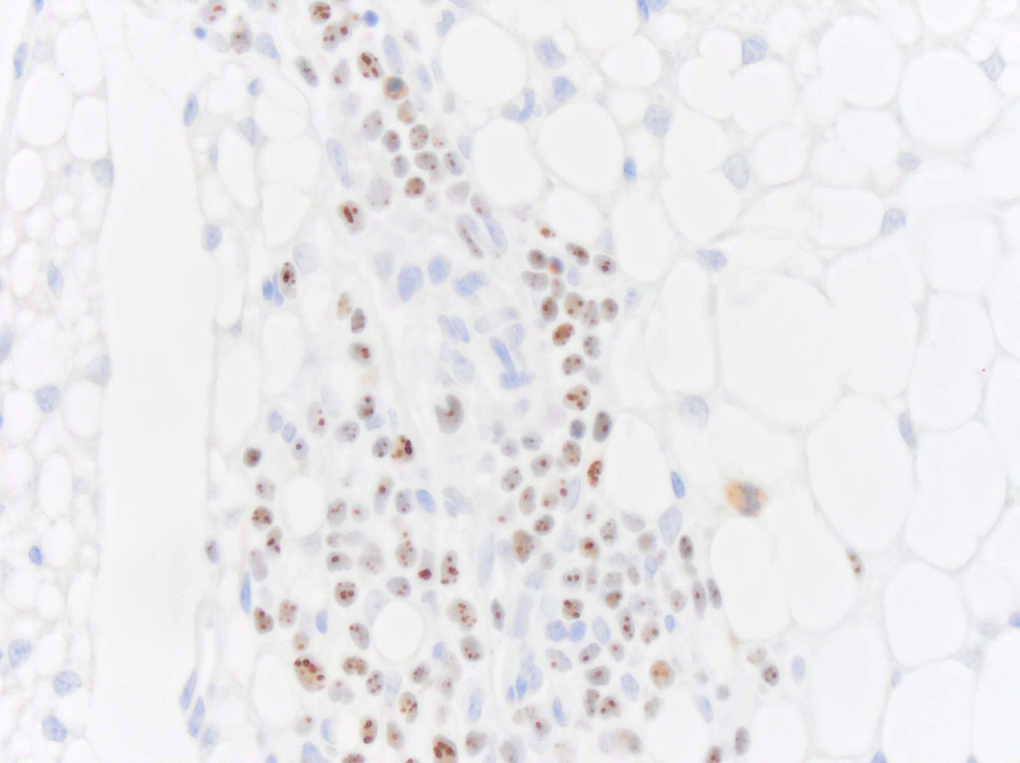 Immunohistochemistry-Paraffin: Mouse Monoclonal Nucleoli Marker Antibody (NM95) [Biotin] [NBP2-34695B] - Nucleoli Marker Antibody (NM95) immunoreactivity in adipose surrounding mouse kidney. The antibody was diluted 1 to 100 and left on tissue sections for 16h at 4 degrees Celsius. Image from a verified customer review.