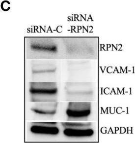 Knockdown of RPN2 decreased luminal B BC cell dissemination in vivo. Luminal B ER+ T47D cells, transfected with negative control siRNA (siRNA-C) or siRNA targeting RPN2 (siRNA-RPN2) were injected + estradiol (E2) ± neutrophils (Neu) into zebrafish transgenic embryos with green fluorescent blood vessels & analyzed as described in materials & methods. (A) Migration in vitro (n = 6). (B)In vivo dissemination of transfected T47D in presence of E2 ± Neu (n = 23–26). Scale bar = 100 µm. (n = 23–26). (C) Western blot analysis for confirmation of siRNA-RPN2 transfection & VCAM-1, ICAM-1, & MUC-1 expression. (D) Focal adhesions area (n = 5–6). Scale bar = 10 µm. (E) Proliferation (n = 6). Representative images of zebrafish embryos with disseminated luminal B T47D BC cells & immunocytochemistry analysis of vinculin expression are shown. Arrows show disseminated T47D & arrowheads show focal adhesions. BV = blood vessels. Data are presented as mean ± SEM. Two-tailed Student’s t-test *P < 0.05, ***P < 0.001, ns, not significant. Data are represented of at least two independent experiments. Image collected & cropped by CiteAb from the following publication (//pubmed.ncbi.nlm.nih.gov/33330095), licensed under a CC-BY license. Not internally tested by Novus Biologicals.