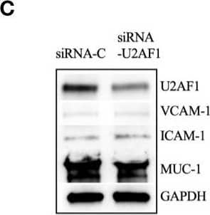 Knockdown of U2AF1 decreased luminal A BC cell dissemination in vivo. Luminal A ER+ MCF-7 cells, transfected with negative control siRNA (siRNA-C) or siRNA targeting U2AF1 (siRNA-U2AF1) were injected in presence of estradiol (E2) ± neutrophils (Neu) into zebrafish transgenic embryos, with green fluorescent blood vessels, & analyzed as described in materials & methods. (A) Migration in vitro (n = 6–12). (B)In vivo dissemination in presence of E2 ± Neu (n = 38–41). Scale bar = 100 µm. (C) Western blot analysis for confirmation of siRNA-U2AF1 transfection & ICAM-1, VCAM-1, & MUC-1 expression. (D) Focal adhesion area (n = 7). Scale bar = 10 µm. (E) Proliferation in vitro (n = 12). Representative images of zebrafish embryos with disseminated MCF-7 cells & immunocytochemistry analysis of vinculin expression are shown. Arrows show disseminated MCF-7 cells & arrowheads show focal adhesions. BV = blood vessels. Data are presented as mean ± SEM. Two-tailed Student’s t-test *P < 0.05, **P < 0.01, ns, not significant. Data are represented of at least two independent experiments. Image collected & cropped by CiteAb from the following publication (//pubmed.ncbi.nlm.nih.gov/33330095), licensed under a CC-BY license. Not internally tested by Novus Biologicals.