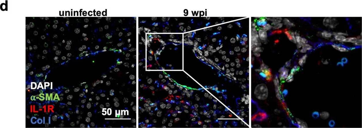 Cells expressing IL-1⍺ & IL-1R are observed in the fibrotic liver environment. (a) Cytokines in tissue lysates from mice at 9 wpi were measured by ELISA in liver. Data are presented as fold change relative to the mean of uninfected levels. N = 11–12 mice per group, pooled from three independent experiments. (b) IL-1 alpha  levels in the sera at 9 wpi measured by ELISA. N = 9–14 mice per group, pooled from four independent experiments. (c) Immunofluorescence labeling of nuclei (DAPI white), IL-1⍺ (green), CD45 (red), & collagen1⍺1 (blue) in the liver of UI or 9 wpi WT mice. Number of cells staining positive for CD45 and/or IL-1⍺, average 2–3 fields of view where immune infiltrate was present from 3 mice per  condition are quantified on the right. Error bars are standard deviation. (d) Immunofluorescent labeling of nuclei (DAPI white), ⍺-smooth muscle actin (green), IL-1R (red), & collagen1⍺ (blue) in the liver of uninfected or 9 wpi WT. Inset, arrow head represents ⍺-smooth muscle actin/IL-1R co-staining cells (arrow heads). Number of cells staining positive for IL-1R and/or ⍺-SMA, average of 4–8 fields of view from 3 mice are quantified on the right. Error bars are standard deviation. (c,d) represent maximum intensity projections of 9–13 μm thick z-stacks. Scale bar represents 50 μm. Error bars are standard error of the mean except where noted otherwise. *P < 0.05; **P < 0.01; ***P < 0.001 by unpaired Student’s t test. Image collected & cropped by CiteAb from the following publication (//pubmed.ncbi.nlm.nih.gov/32973293), licensed under a CC-BY license. Not internally tested by Novus Biologicals.