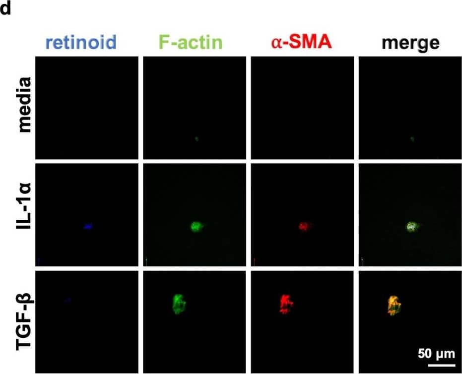 Immunocytochemistry/ Immunofluorescence: alpha-Smooth Muscle Actin Antibody (SPM332) [Allophycocyanin] [NBP2-34760APC] - IL-1 induces contractility & alpha smooth muscle actin expression in murine embryonic fibroblasts & primary hepatic stellate cells. (a–c) MEFs were incubated with media, 10 ng/mL IL-1 alpha , 150 pg/mL IL-1 beta  or 10 ng/mL TGF beta -1 for 48 h. After fixation, MEFs were stained for F-actin, & alpha-smooth muscle actin ( alpha -SMA). Cell spreading was quantified in (b), & levels of  alpha -SMA expression were quantified in (c) as the mean relative to untreated for each biological replicate (left panels) or the single cell data pooled from three biological replicate experiments (right panels). For each experiment, 50–200 cells/group were analyzed. (d–f) Primary hepatic stellate cells (HSCs) were isolated from uninfected mouse livers, & FACS-sorted based on endogenous retinoid fluorescence (d). (e,f) HSCs were seeded onto 4 kPa hydrogels coated with 10 μg/mL of fibronectin & cultured with 10 ng/mL IL-1 alpha , 10 ng/mL TGF-beta , or media alone for 48 h & then fixed & stained for F-actin &  alpha -SMA & imaged by confocal microscopy. Scale bar represents 50 μm. Total cell area quantified in (e) & levels of  alpha -SMA expression were quantified in terms of pixels/cell in (f) as the mean relative to untreated for each biological replicate (left panels) or the single cell data pooled from four biological replicate experiments (right panels). Error bars are standard error of the mean. For the left panels, data were compared by one-way ANOVA with Bonferroni’s multiple comparisons test. Image collected & cropped by CiteAb from the following publication (//pubmed.ncbi.nlm.nih.gov/32973293), licensed under a CC-BY license. Not internally tested by Novus Biologicals.