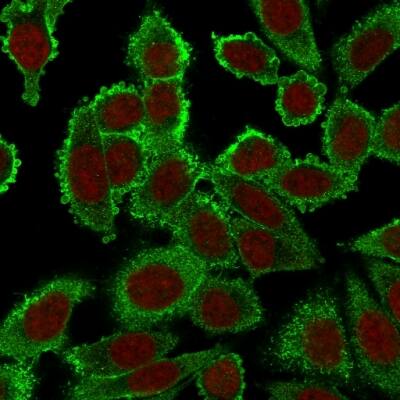 Immunofluorescence Analysis of PFA fixed HeLa cells labeling Moesinwith Moesin Antibody (SPM562) - Azide and BSA Free followed by Goat anti-mouse IgG-CF488 (Green). The nuclear counterstain is Reddot (Red).