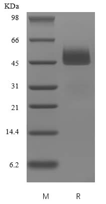 SDS-Page: Recombinant Human Serpin I1/Neuroserpin Protein [NBP2-35075]