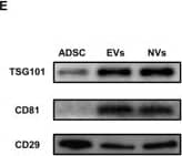 Generation and characterization of ADSC-EVs and ADSC-NVs. A TEM images of ADSC-EVs and ADSC-NVs. Scale bar: 100 nm. B NTA analysis of ADSC-EVs and ADSC-NVs. The peak diameter of both ranged between 100 and 150 nm. C, D The yields of EVs and NVs from equivalent ADSCs were examined by particle number (C) and the protein amount (D) (n = 3 per group). E Protein expression of TSG101, CD81, and CD29 was assessed by western blot analysis for ADSC-EVs (EVs), ADSC-NVs (NVs), and ADSC. F-H The internalization of PKH26-labeled ADSC-EVs and ADSC-NVs in equivalent amount particles by HUVECs was evaluated at 1, 2, 3 and 4 h respectively. The internalization rate (F) was measured by calculating area ratio between ADSC-EVs/ ADSC-NVs and HUVECs (n = 3 per group). G, H Representative images of internalization of ADSC-EVs or ADSC-NVs at 1, 2, 3, 4 h. Scale bar: 100 μm. Red: ADSC-EVs/NVs, Green: HUVECs, blue: Nucleus of HUVECs. ns, no significant difference, ***p < 0.001, ****p < 0.0001 Image collected and cropped by CiteAb from the following open publication (//pubmed.ncbi.nlm.nih.gov/36528594), licensed under a CC-BY license. Not internally tested by Novus Biologicals.