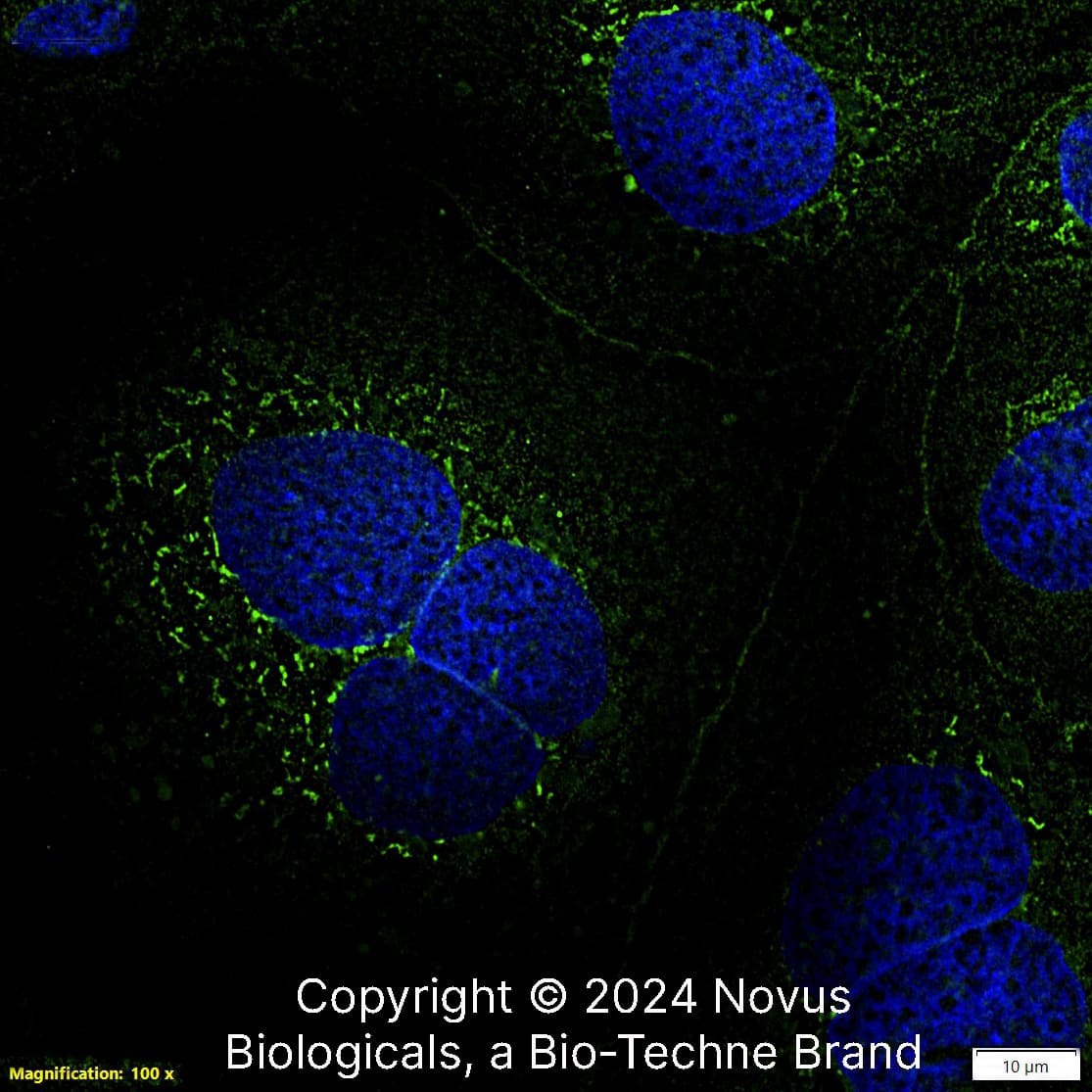 Calnexin (IE2.1C12) was detected in immersion fixed Caco-2 human colorectal adenocarcinoma cell line using Mouse anti-Calnexin (IE2.1C12) Protein G Purified Monoclonal Antibody conjugated to Alexa Fluor® 488 (Catalog # NBP2-36571AF488) (green) at 10 µg/mL overnight at 4C. Cells were counterstained with DAPI (dark blue). Cells were imaged using a 100X objective and digitally deconvolved.