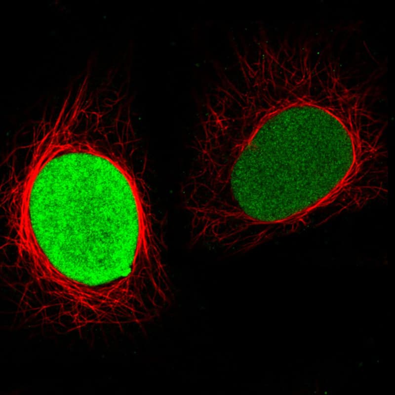 Staining in MCF7 cell line with Anti-PARP1 monoclonal antibody, showing clear cycle dependent nuclear staining in green. Microtubule- and nuclear probes are visualized in red and blue respectively (where available).
