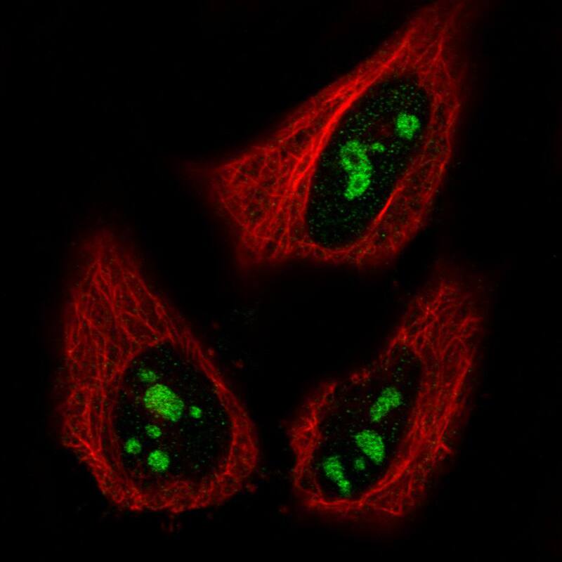 Immunocytochemistry/ Immunofluorescence NIFK Antibody (CL2240) - BSA Free