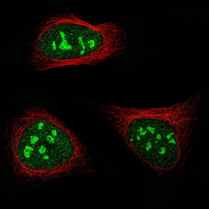 Immunocytochemistry/ Immunofluorescence NIFK Antibody (CL2237) - BSA Free
