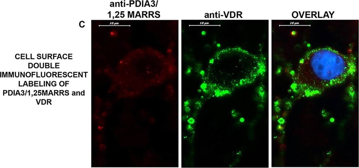 The expression of VDR and PDIA3/1,25MARRS in cortical neurons.A-B) Cell surface staining of VDR (green) in live neurons, followed by fixation and immunofluorescence labeling of MAP2 (red) as a neuronal marker, 100x. The micrographs were taken from the same areas with different levels of focus to demonstrate the different localization of VDR on the neuronal plasma membrane. A) VDR protein is localized on the plasma membrane of the soma; B) VDR protein is localized on the plasma membranes of neurites. The 3D image of staining was obtained via confocal microscopy (63x), and the video is presented in S1 Video. C) VDR (green) and PDIA3/1,25MARRS (red) cell surface staining with live neurons via double immunofluorescence labelling, 100x. The localization of PDIA3/1,25MARRS on the neuronal plasma membrane was very limited. D) Double immunofluorescence labelling of VDR and PDIA3/1,25MARRS in fixed and permeabilized neurons, 100x. PDIA3/1,25MARRS was localized in the cytoplasm and in the endoplasmic reticulum (ER). Given its strong reactivity in a certain area in the cytoplasm and its known role as an ER chaperone, the localization was considered to be in the ER. VDR is located in the nucleus, cytoplasm, ER and axon hillock. VDR and PDIA3/1,25MARRS might co-localize in the cytoplasm, especially in the ER. E) VDR (green) cell surface staining with live SH-SY5Y cells via immunofluorescence labelling, 100x. F) Immunofluorescence labelling of VDR in fixed and permeabilized SH-SY5Y cells, 100x. Image collected and cropped by CiteAb from the following open publication (//pubmed.ncbi.nlm.nih.gov/29176823), licensed under a CC-BY license. Not internally tested by Novus Biologicals.