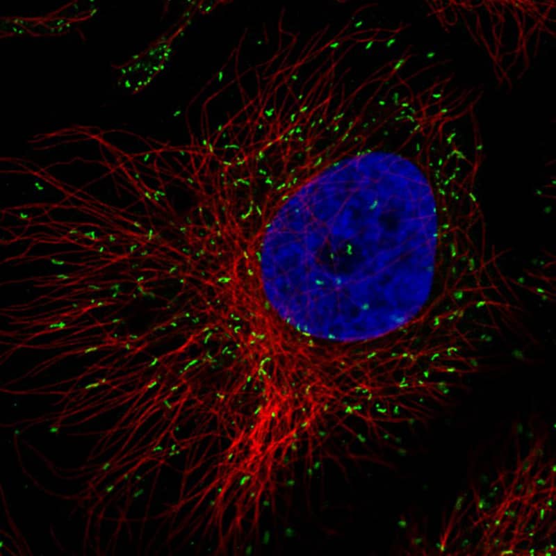 Staining in A431 cell line with Anti-ABCD3 monoclonal antibody, showing specific staining of peroxisomes in green. Microtubule- and nuclear probes are visualized in red and blue respectively (where available).