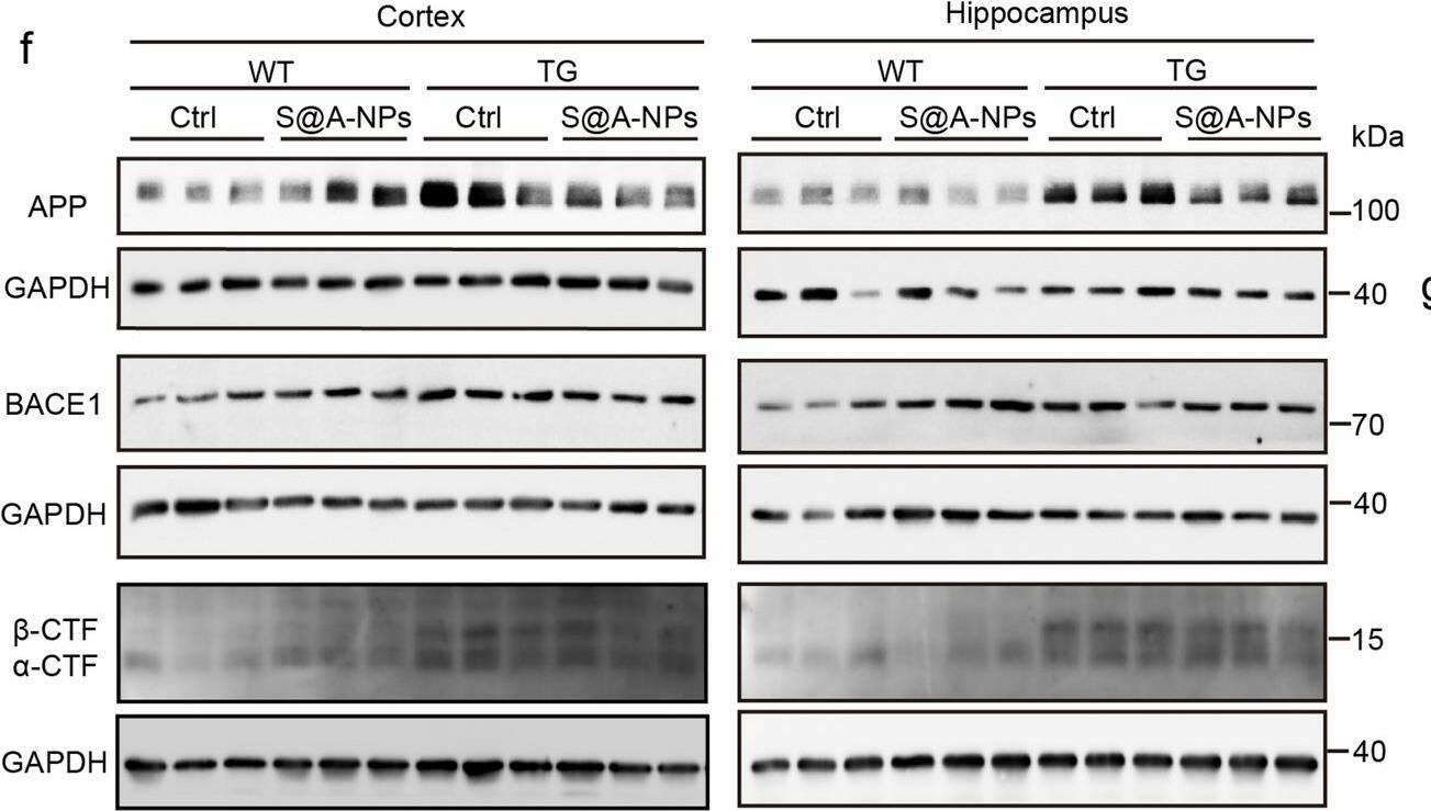 S@A-NPs treatment suppresses amyloidogenic cleavage of APP, while enhancing transcytosis of A  beta out of the brains of APP/PS1 transgenic mice. (a) Schematic description of experimental timeline. APP/PS1 mice were intravenously injected with S@A-NPs at 6 months of age and subjected to analysis of A beta  clearance at 7 months of age. SF555-conjugated A beta  oligomers were stereotactically injected into the hippocampal DG. (b, c) SF555-conjugated A beta  remnants in the brains were shown 48 h after injection. Area of SF555-conjugated A beta  oligomers occupied in the hippocampal DG (c). (d, e) ELISA analysis of A beta 42 (d) and A beta 40 (e) levels in the plasma. (f) WB analysis of levels of full-length APP, BACE1 and  alpha / beta -CTF in the cortex and hippocampus. GAPDH was detected as a loading control. Relative levels of full-length APP (f, g), BACE1 (f, h),  beta -CTF (f, i), and  alpha -CTF (f, j). Data are presented as mean +/- SEM. n = 3 mice/group (c); n = 7–9 mice/group (d); n = 6–11 mice/group (e); n = 3–8 mice/group (g-j). * p < 0.05; ** p < 0.01; *** p < 0.001. One-way ANOVA (c-e, g-j). Scale bars: 100 μm (b) Image collected and cropped by CiteAb from the following open publication (//pubmed.ncbi.nlm.nih.gov/40830501), licensed under a CC-BY license. Not internally tested by Novus Biologicals.