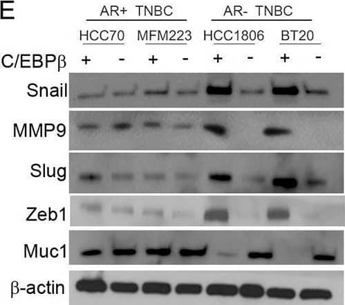 Silencing of KIFC1 and C/EBP beta  reduces invasion and EMT in AR-TNBC cells. (A–D) Representative images (A) and bar graphs (B-D) of control (A, B–D), C/EBP beta  KD (A, B), KIFC1 KD (A, C), and CW069-treated (A, D) and AR + TNBC and AR-TNBC cell lines. (E, F) Immunoblots showing expression levels of various EMT markers in KIFC1 KD (E) and C/EBP beta  KD in AR + TNBC and AR-TNBC cells (F). HCC70, MFM223 (AR + TNBC); HCC1806, BT20 (AR-TNBC). Bars indicate mean +/- SEM. Unpaired two-tailed Student’s t-test with Welch’s correction was used to determine statistical significance. *P < 0.05, **P < 0.005, ****P < 0.00005, ns = non-significant Image collected and cropped by CiteAb from the following open publication (//pubmed.ncbi.nlm.nih.gov/40448099), licensed under a CC-BY license. Not internally tested by Novus Biologicals.