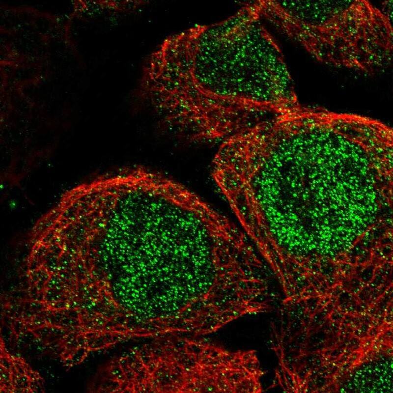 Staining of human cell line A-431 shows localization to nucleoplasm & cytosol.
