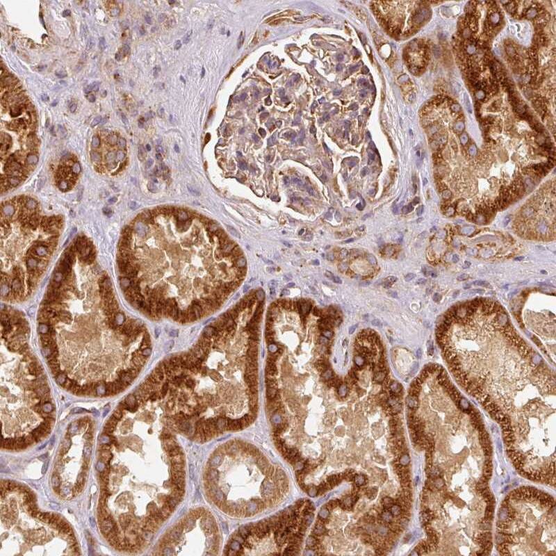 <b>Independent Antibodies Validation. </b>Staining of human kidney shows strong cytoplasmic positivity in cells in tubules.