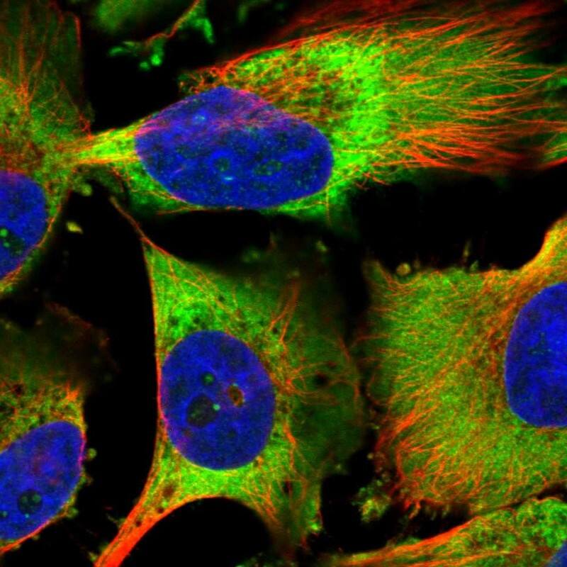 Staining of human cell line U-251 MG shows localization to nucleoli fibrillar center & cytosol.