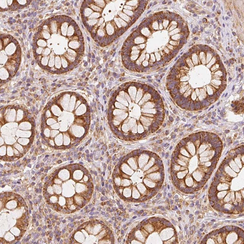 Staining of human rectum shows strong cytoplasmic positivity in glandular cells.