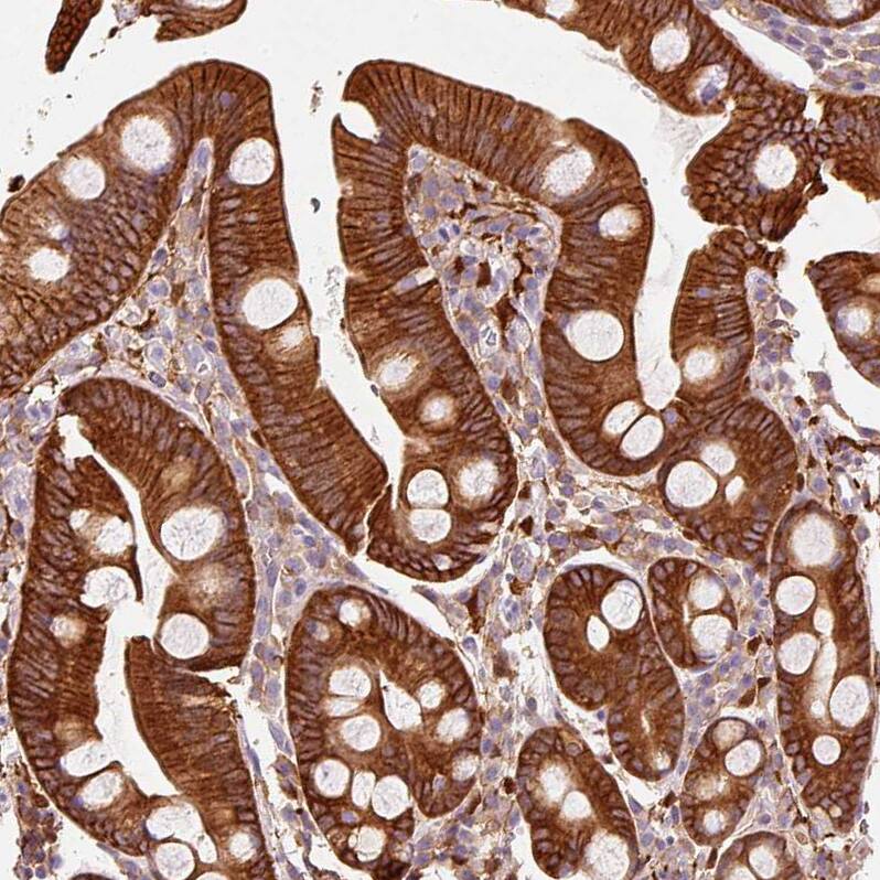 Staining of human small intestine shows strong membranous  and cytoplasmic positivity in glandular cells.