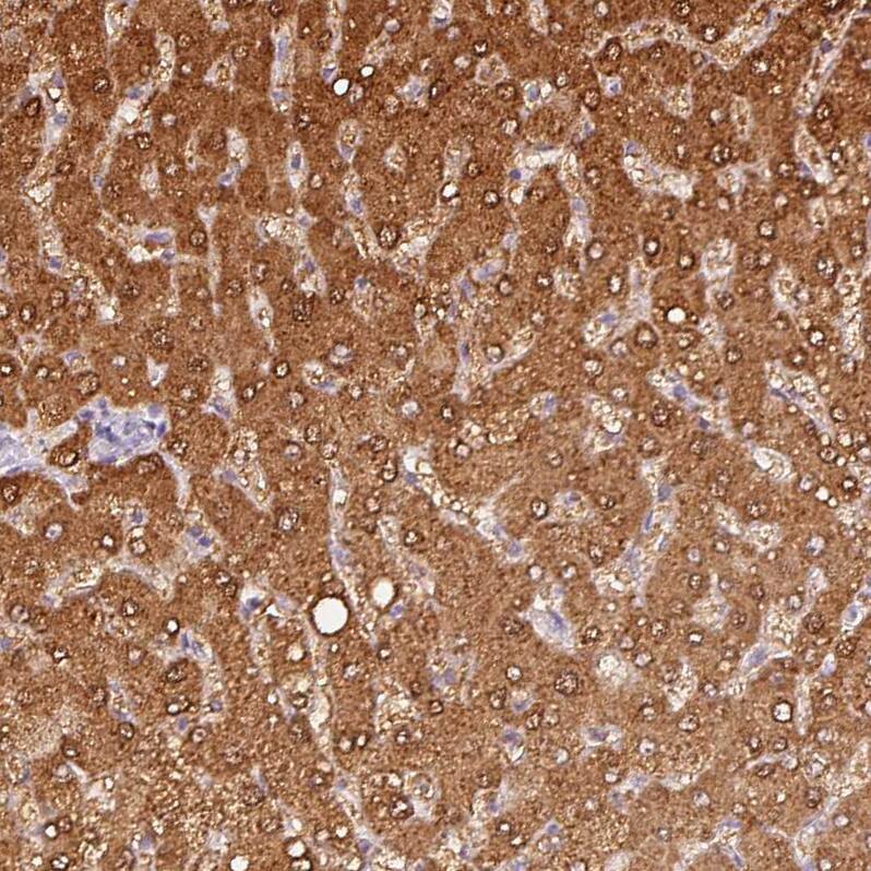 Staining of human liver shows moderate cytoplasmic positivity in hepatocytes.