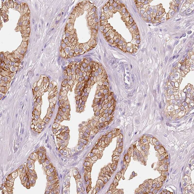 Staining of human prostate shows moderate membranous and cytoplasmic positivity in glandular cells.