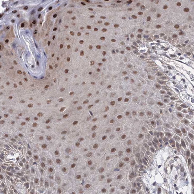 Immunohistochemistry-Paraffin S5a/Angiocidin Antibody - BSA Free