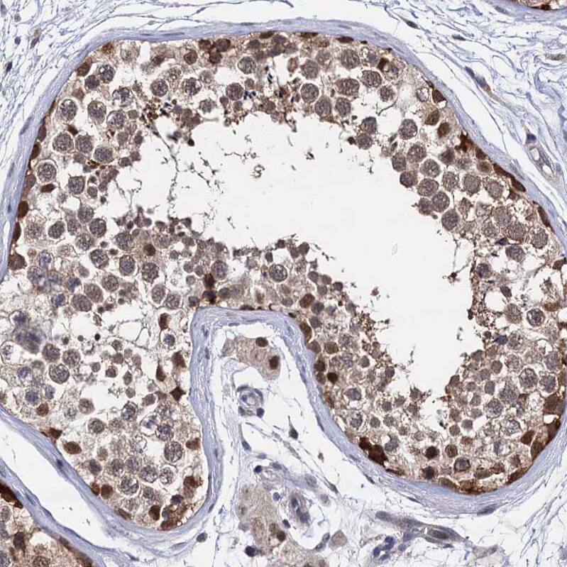 Immunohistochemistry-Paraffin S5a/Angiocidin Antibody - BSA Free