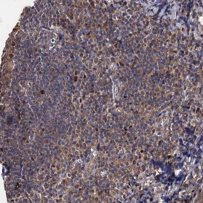 Immunohistochemistry-Paraffin S5a/Angiocidin Antibody - BSA Free