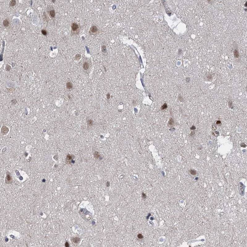 Immunohistochemistry-Paraffin S5a/Angiocidin Antibody - BSA Free