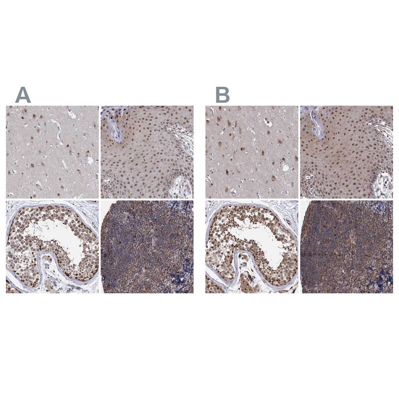 Immunohistochemistry-Paraffin S5a/Angiocidin Antibody - BSA Free