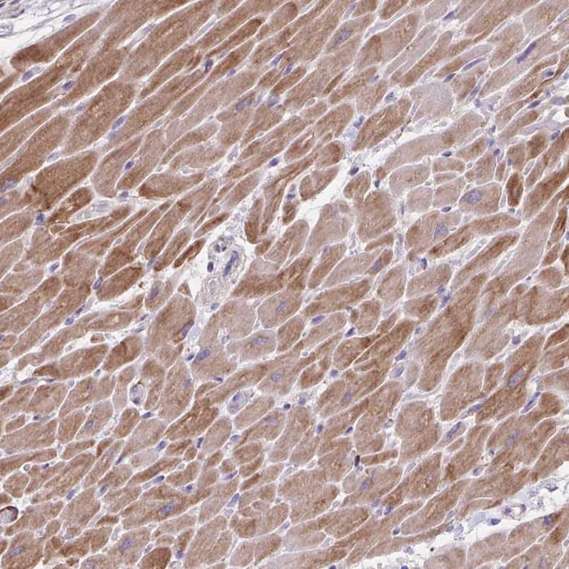 Immunohistochemistry-Paraffin alpha Desmuslin Antibody - BSA Free