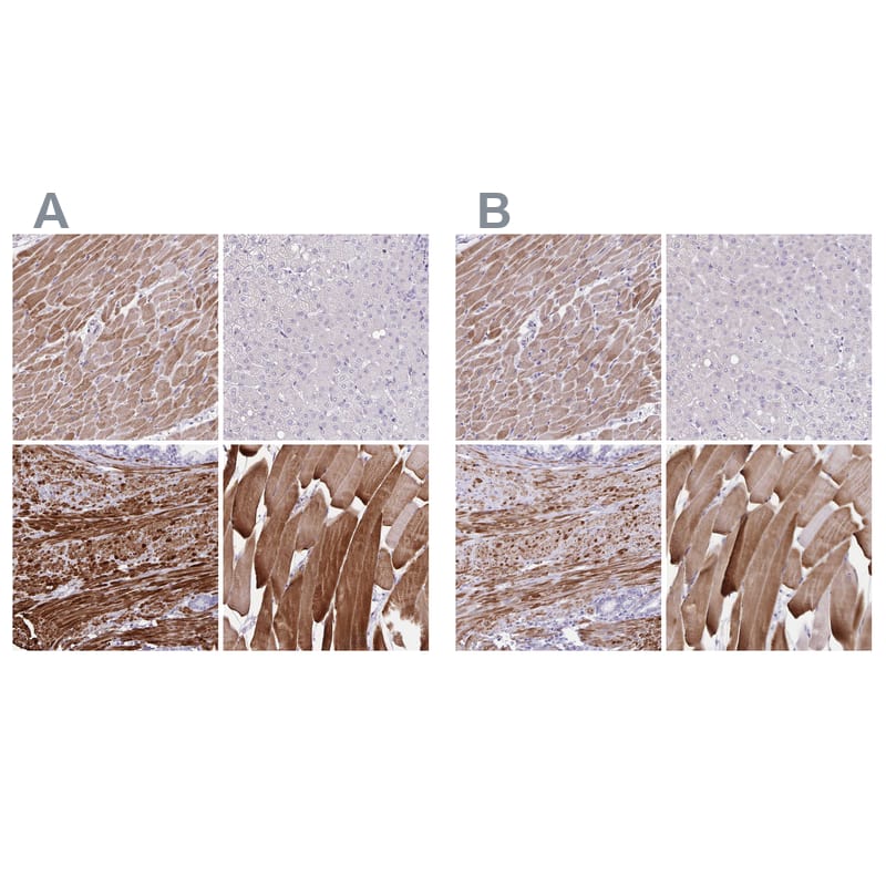 Immunohistochemistry-Paraffin alpha Desmuslin Antibody - BSA Free