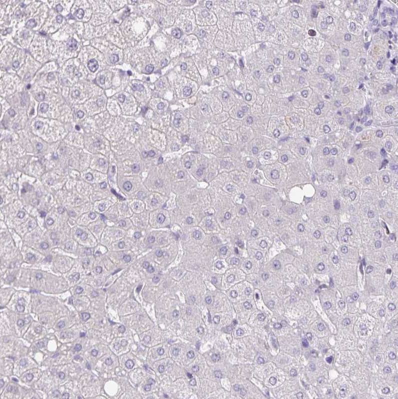 Immunohistochemistry-Paraffin alpha Desmuslin Antibody - BSA Free