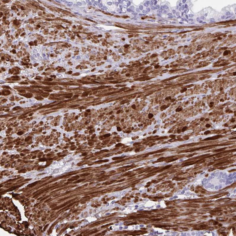 Immunohistochemistry-Paraffin alpha Desmuslin Antibody - BSA Free