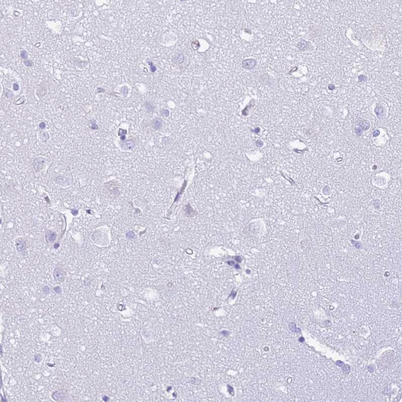 Immunohistochemistry-Paraffin PLBD1 Antibody - BSA Free
