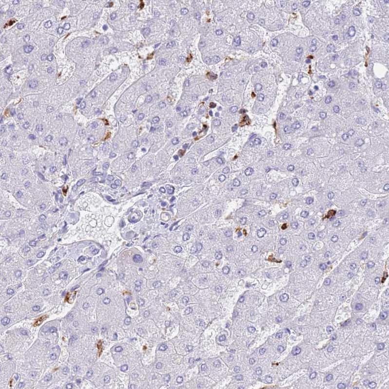 Immunohistochemistry-Paraffin PLBD1 Antibody - BSA Free
