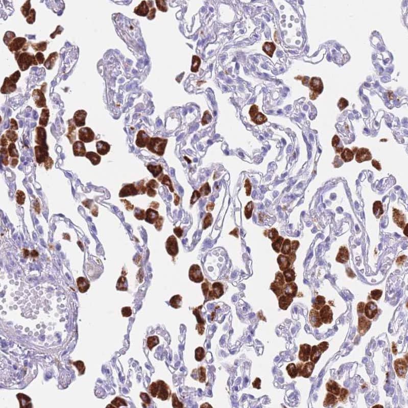 Immunohistochemistry-Paraffin PLBD1 Antibody - BSA Free