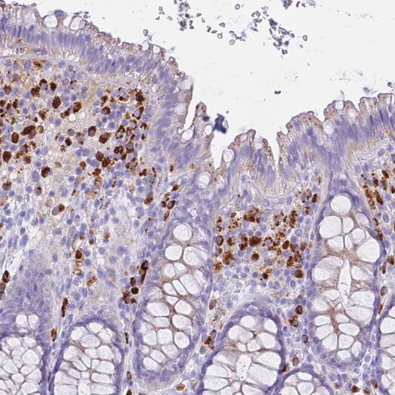Staining of human rectum shows strong cytoplasmic positivity in lymphoid cells.