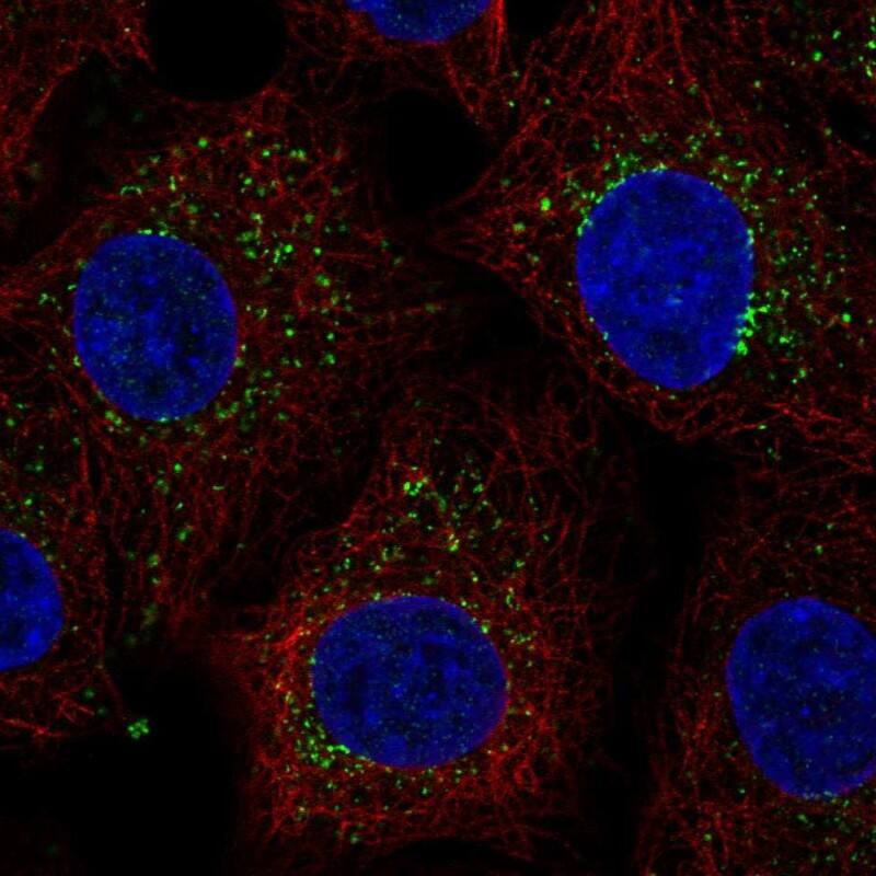 Staining of human cell line A549 shows localization to vesicles.