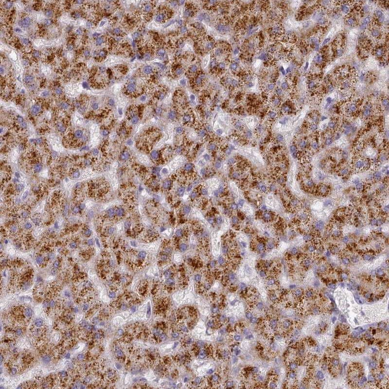 Staining of human liver shows strong cytoplasmic positivity in hepatocytes.