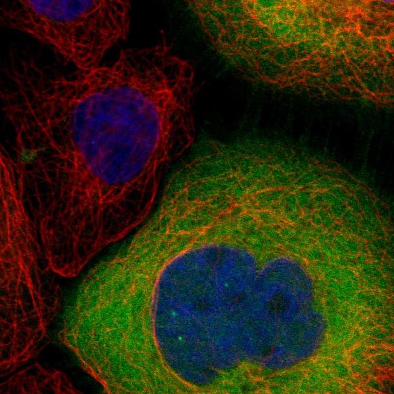 Staining of human cell line A-431 shows localization to cytosol.