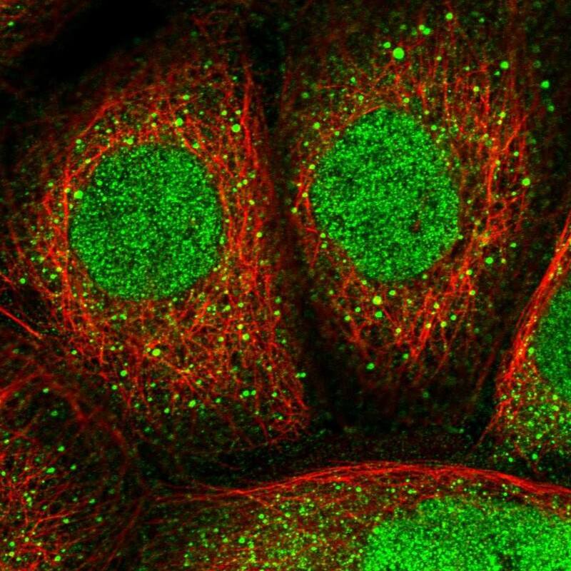 Staining of human cell line A-431 shows localization to nucleus & vesicles.
