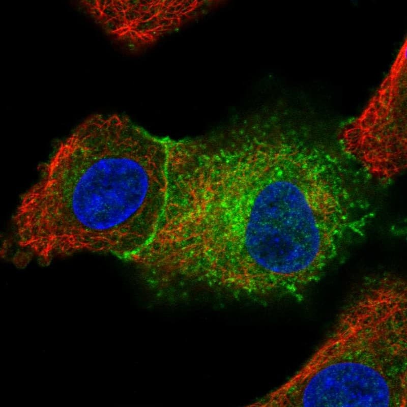 <b>Orthogonal Strategies Validation. </b>Staining of human cell line A549 shows localization to plasma membrane & cytosol.
