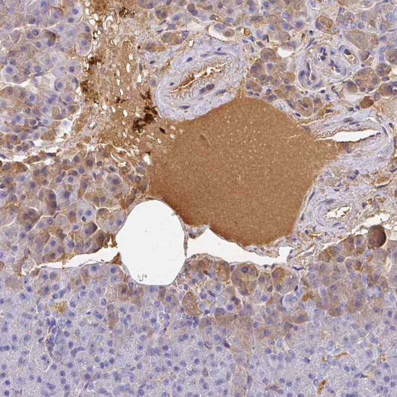 Staining of human pancreas shows strong positivity in plasma.