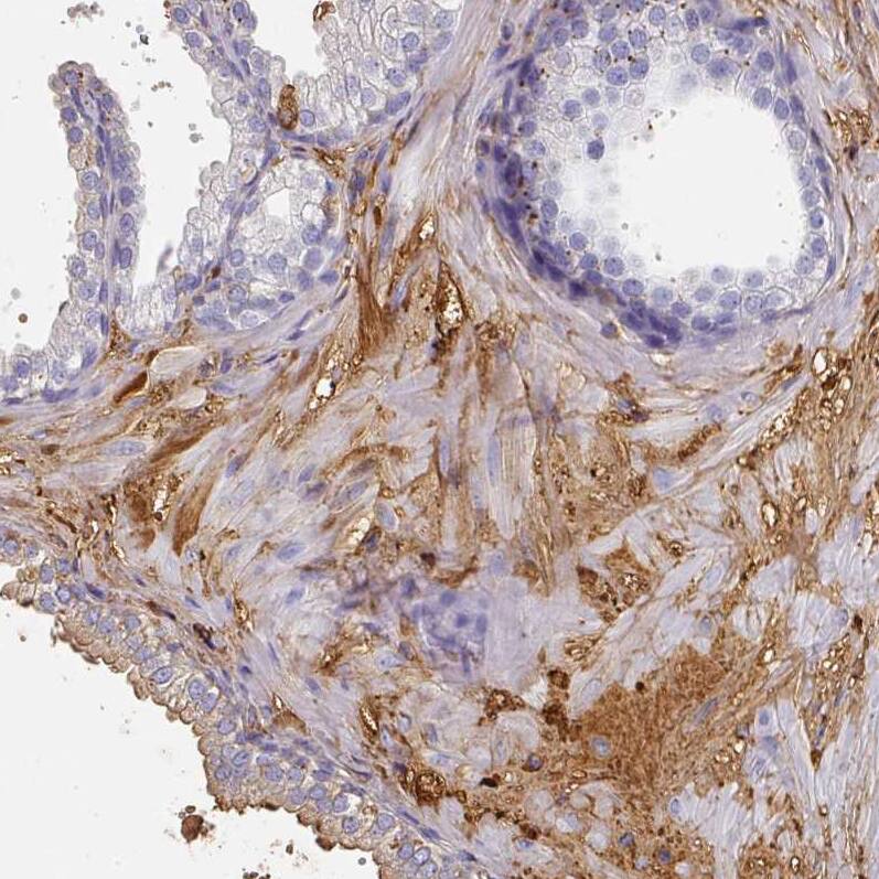 Staining of human prostate shows strong positivity in plasma.